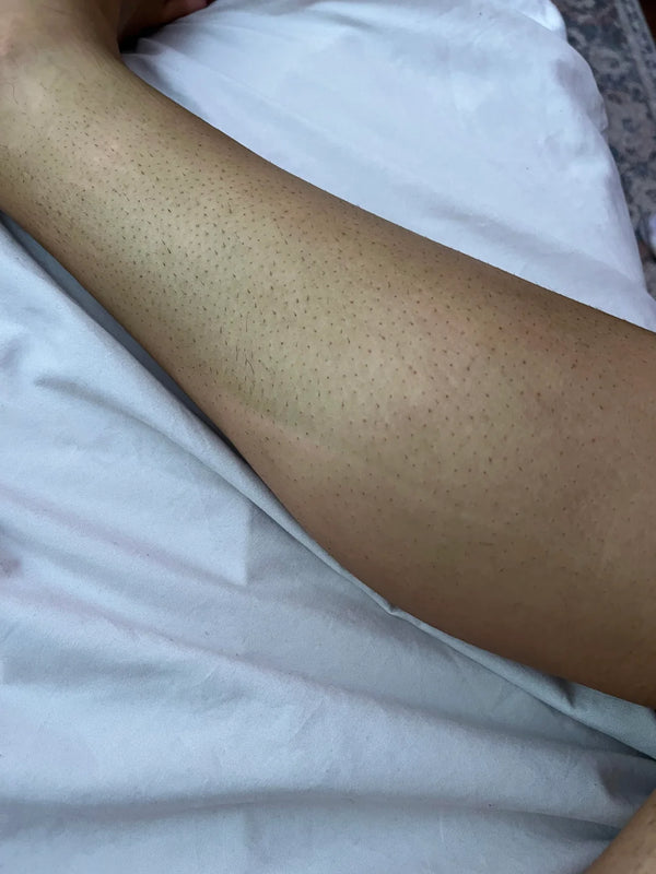 Skin That Pays the Price